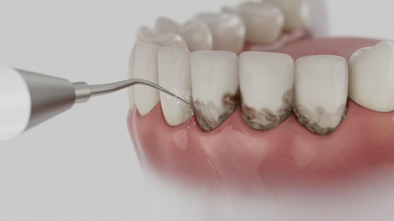Trusted Teeth Cleaning And Checkup service in Champlin, MN - Dentist Open Now